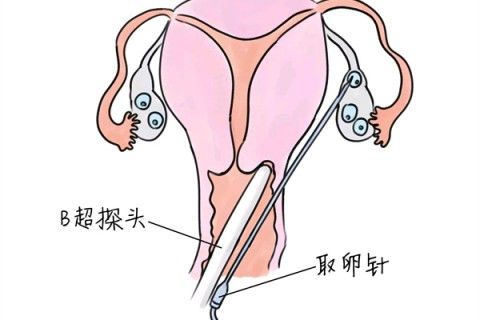 http://jinhua.vdtfzz.com/post/205.html|金华供卵助孕